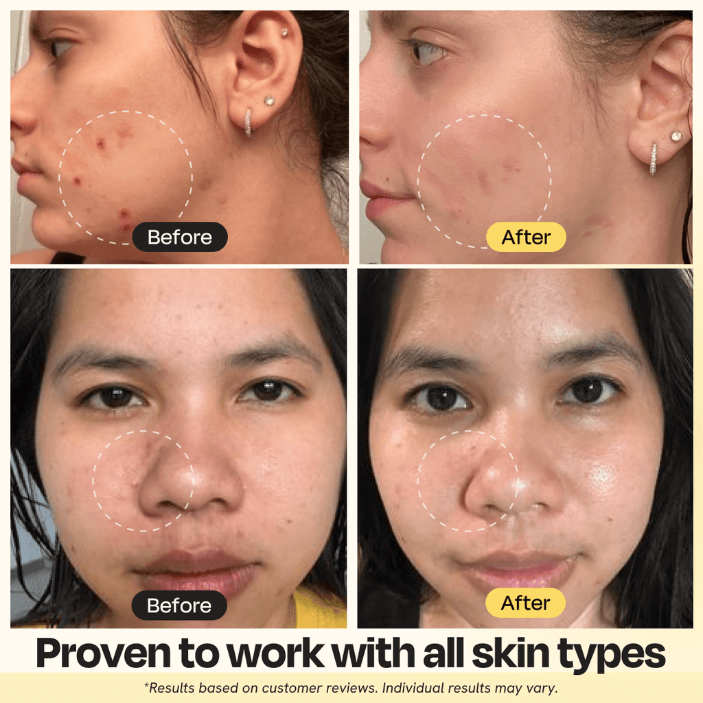 Vitamin C Tonerde-Maske
