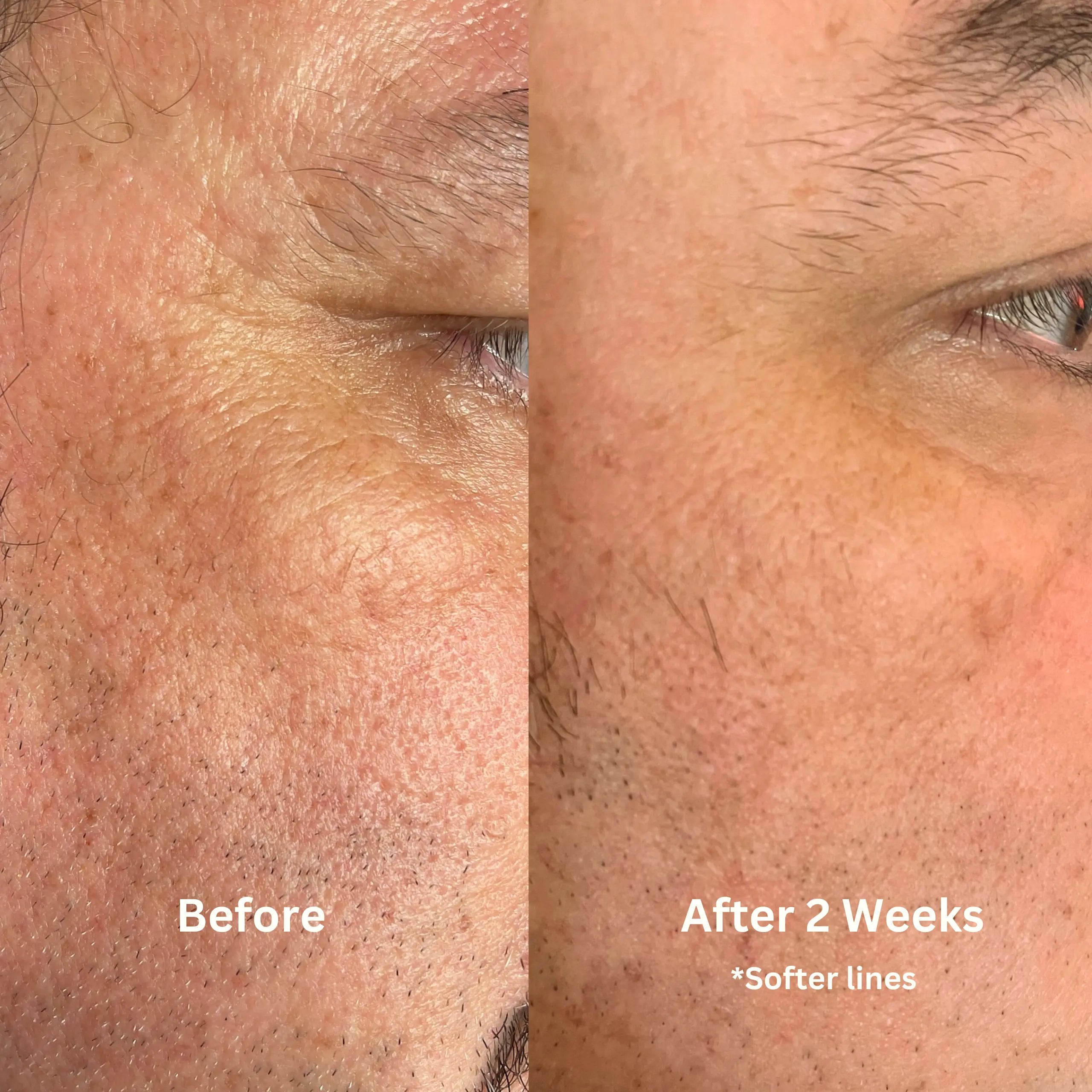 Luster Bakuchiol + Astaxanthin Gesichtsöl Retinol-Alternative