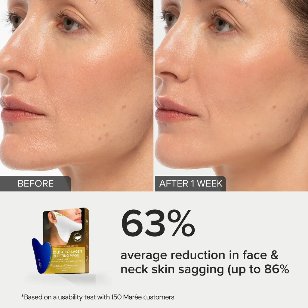 24K Gold V-Line Lifting Maske
