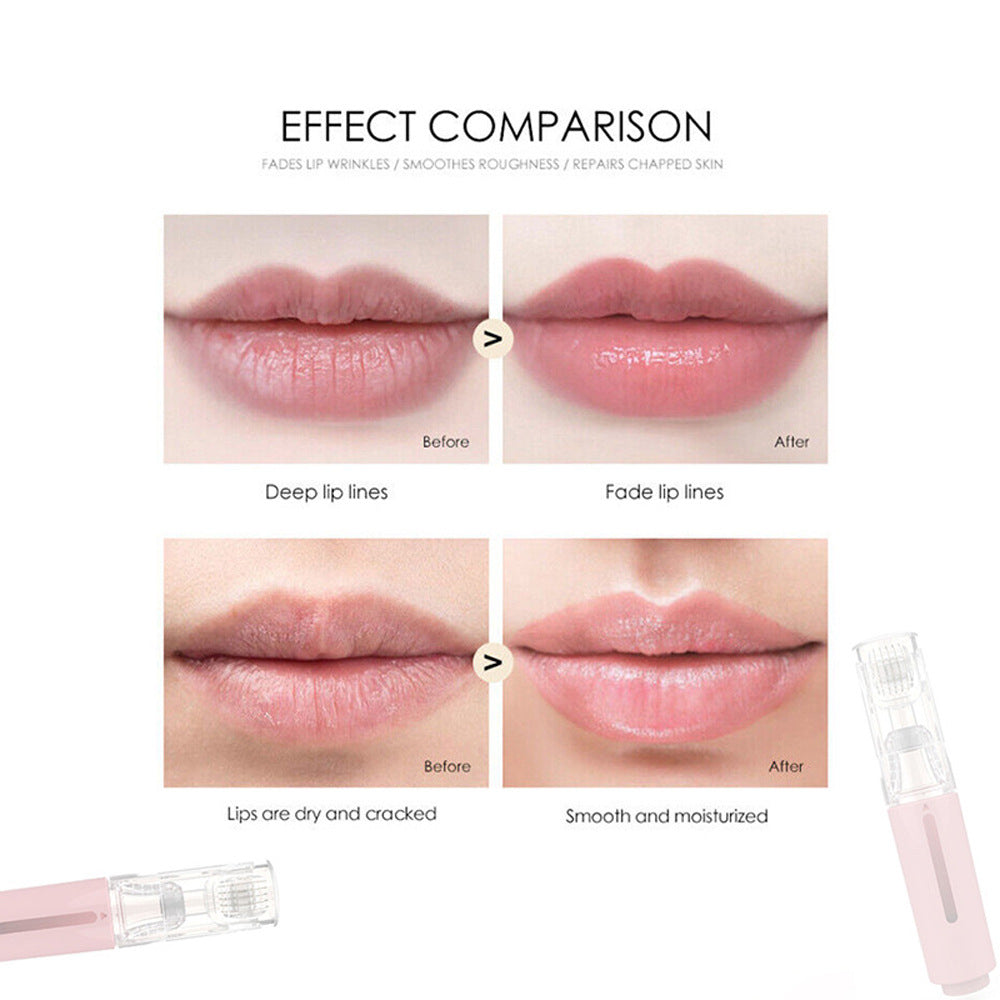 Hochfrequenz-Vibrations-Lippenmassagegerät – unverzichtbar für die Selbstpflege